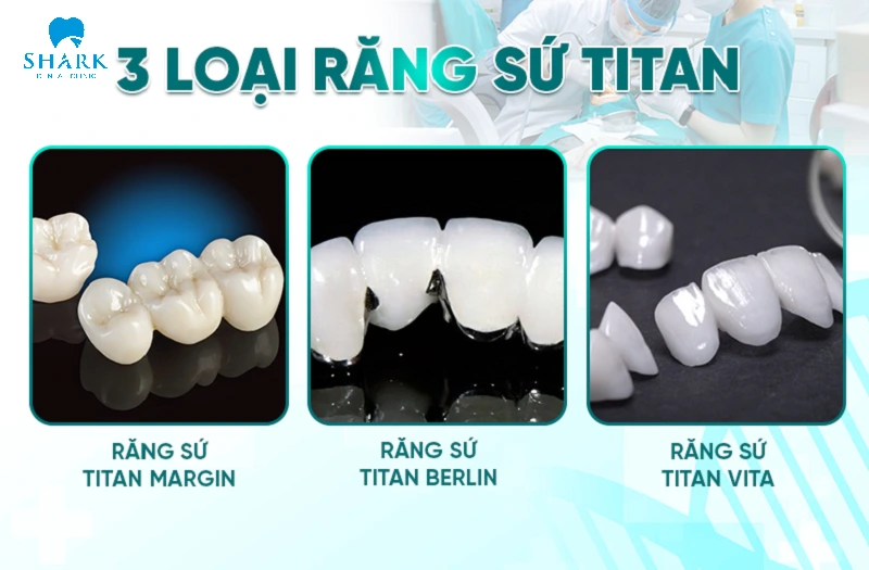 Răng sứ Titan là gì? Bọc răng sứ Titan giá bao nhiêu tiền? 6 Các loại răng sứ titan margin berlin vita phổ biến