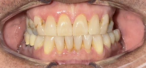 Khách hàng trước thực hiện chính diện