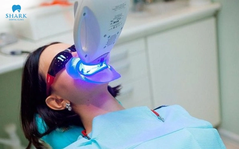 Tẩy trắng răng bằng công nghệ BleachBright có ưu điểm gì? 5 Đây là phương pháp làm trắng răng hiện đại, ứng dụng sự kết hợp giữa gel tẩy trắng nồng độ thấp và hệ thống ánh sáng LED chuyên dụng