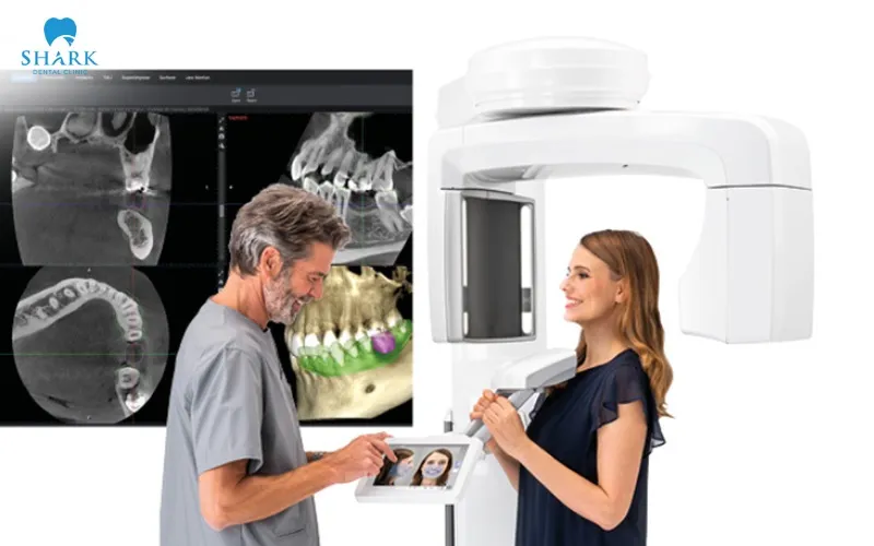 Thủng xoang hàm sau khi nhổ răng khôn có nguy hiểm không? 19 Chụp phim CT ConeBeam 3D là bước rất quan trọng trước khi nhổ răng khôn nhằm hạn chế nguy cơ làm thủng xoang