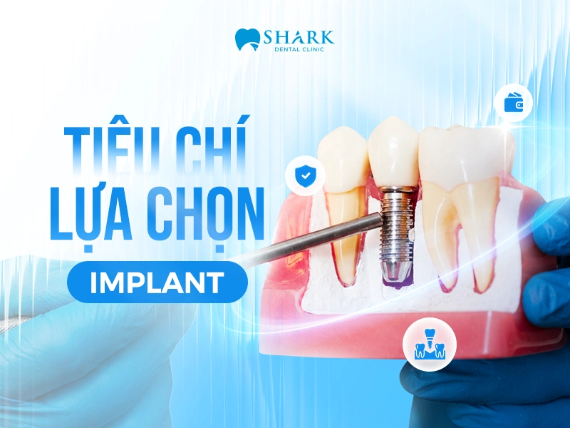 4 dòng trụ được sử dụng tại Nha khoa Shark