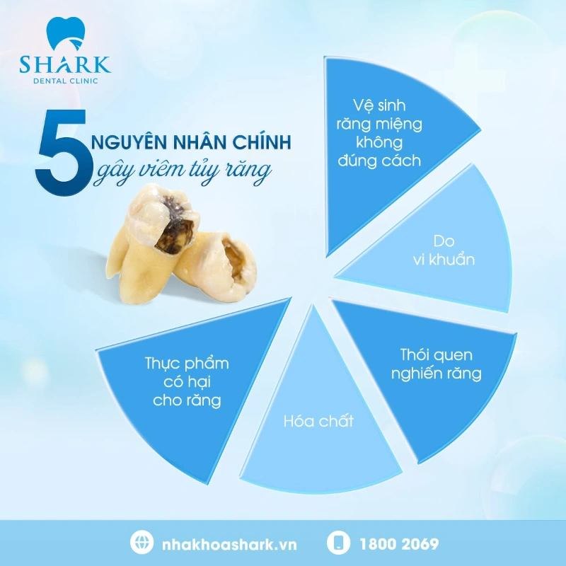 Viêm tủy răng cần phải điều trị ngay