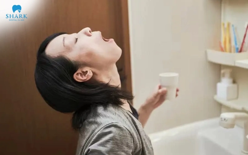 Gai xương sau nhổ răng khôn có nguy hiểm không? Bao lâu hết? 8 Súc miệng kỹ lưỡng khi bị gai xương răng sau khi nhổ