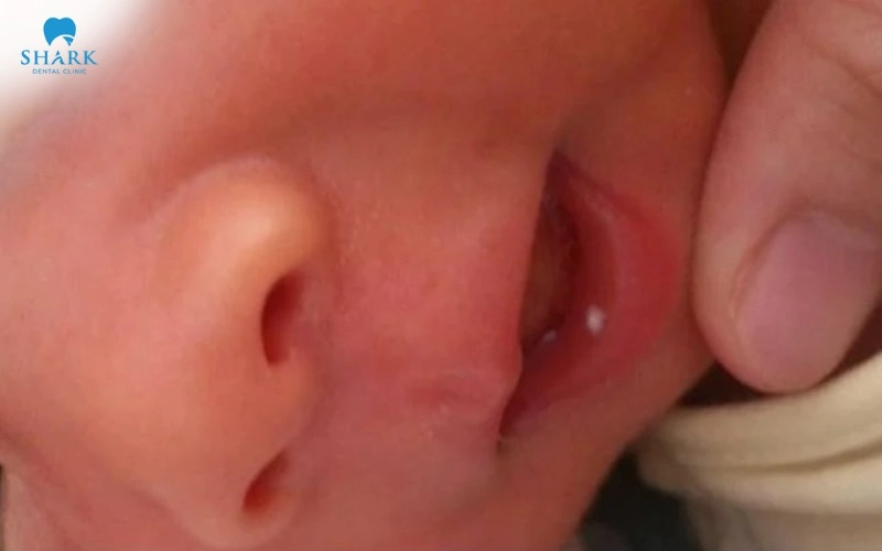 Hình khuôn mặt trước điều trị
