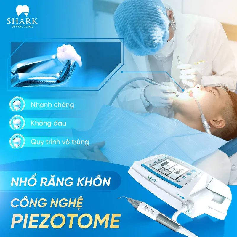 Công nghệ nhổ răng khôn bằng máy siêu âm Piezotome hiện đại, an toàn và nhanh chóng