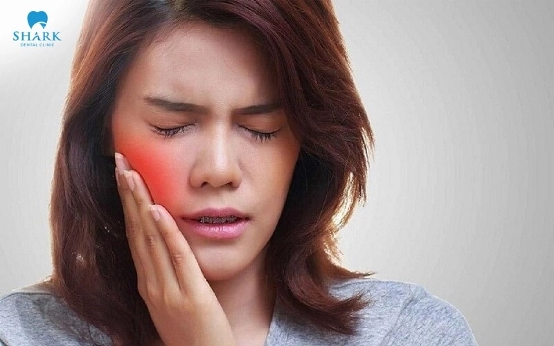 Răng khôn bị sâu vỡ có nguy hiểm không? Tại sao nên nhổ? 6 Răng khôn bị vỡ dễ gây đau nhức