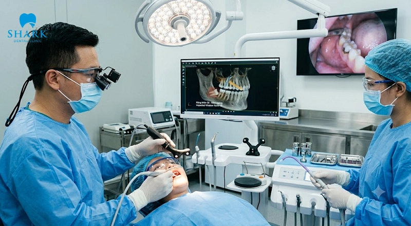 Răng khôn nằm ngang có nên nhổ không? Có nguy hiểm không? 8 Nhổ răng khôn nằm ngang càng sớm càng tốt
