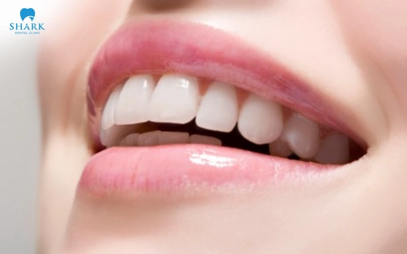 Răng số 3 là răng nào? Giá trồng răng nanh khi bị mất? 10 Răng số 3 tạo nét duyên cho gương mặt