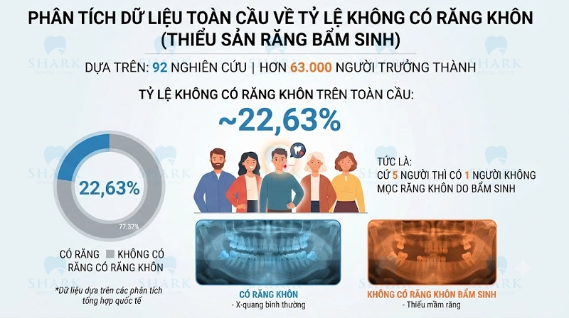 Tại sao có người không mọc răng khôn? Nguyên nhân là gì? 4 Tỷ lệ người không mọc răng khôn hiện nay