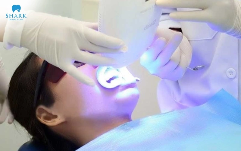 Tẩy trắng răng Brite Smile có tốt không? Giá bao nhiêu tiền? 11 Chi phí tẩy trắng răng Brite Smile không cố định mà phụ thuộc vào nhiều yếu tố khác nhau
