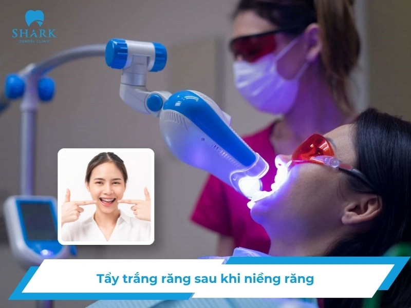 tay trang rang sau khi nieng rang