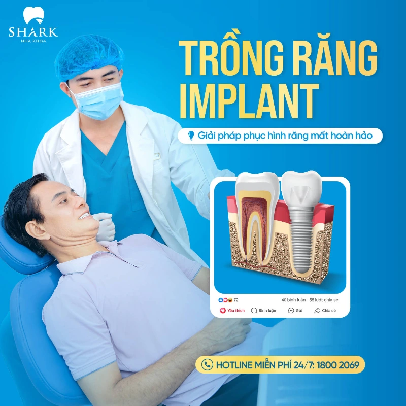 Chỉ nên chọn những nha khoa uy tín để trồng răng số 4