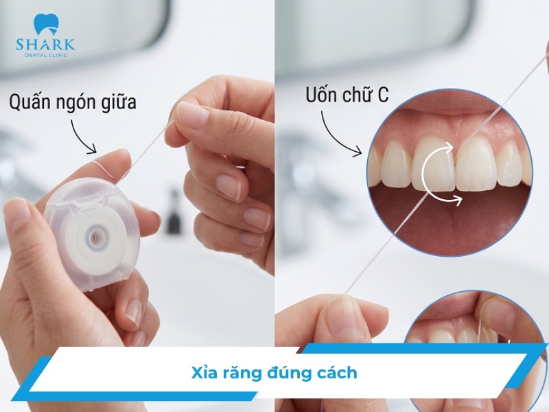 Xỉa răng