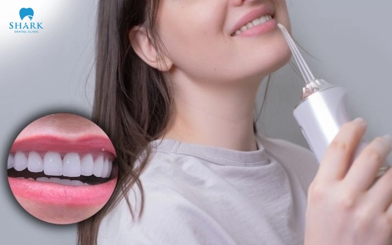 Bọc răng sứ có dùng tăm nước được không? Bác sĩ giải đáp 5 Dùng tăm nước cho răng bọc sứ