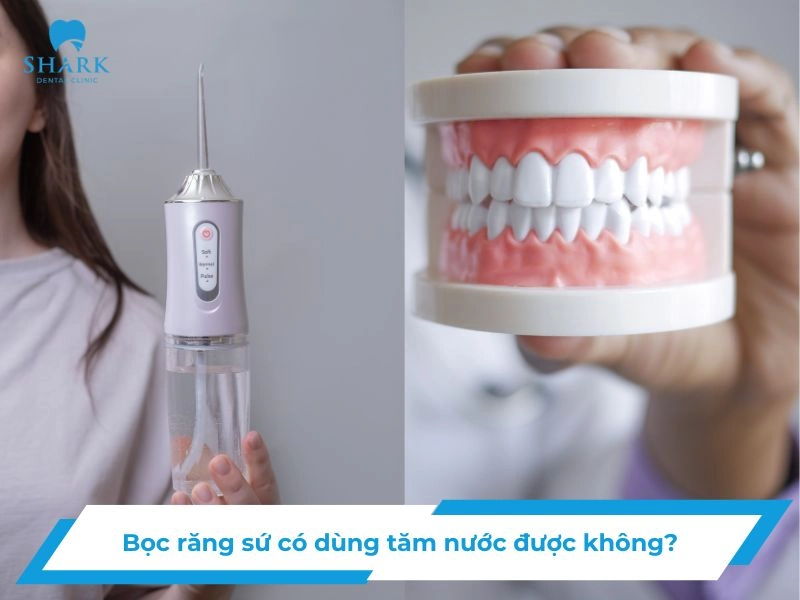 Bọc răng sứ có dùng tăm nước được không