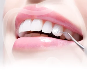 Đính đá thẩm mỹ