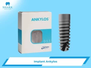 Implant Ankylos là gì? Có xuất xứ ở đâu và giá bao nhiêu?