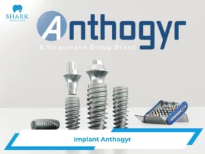 Implant Anthogyr là gì? Trồng răng trụ Anthogyr giá bao nhiêu?