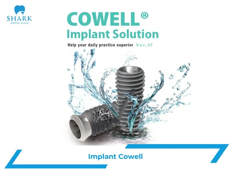 Trụ Implant Cowell là của nước nào? Có tốt không? 7 Implant Cowell