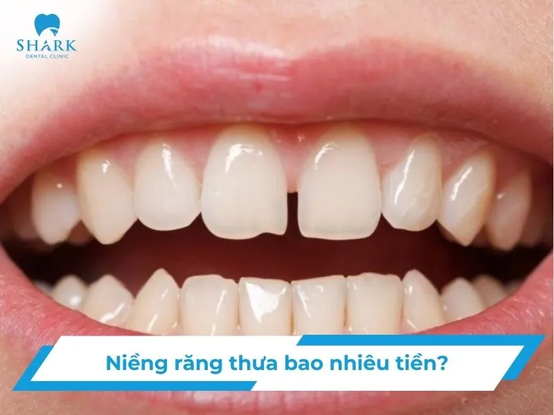 nieng-rang-thua-bao-nhieu-tien_1_11zon