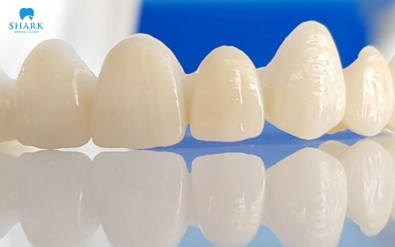 Răng sứ Luxen là gì? Có nên bọc răng sứ Luxen không? 7 Cấu trúc đa lớp phôi sứ Luxen
