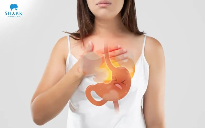 Trào ngược dạ dày hay cảm cúm cũng khiến vùng họng trở nên nhạy cảm cũng có thể gây đau khi nuốt