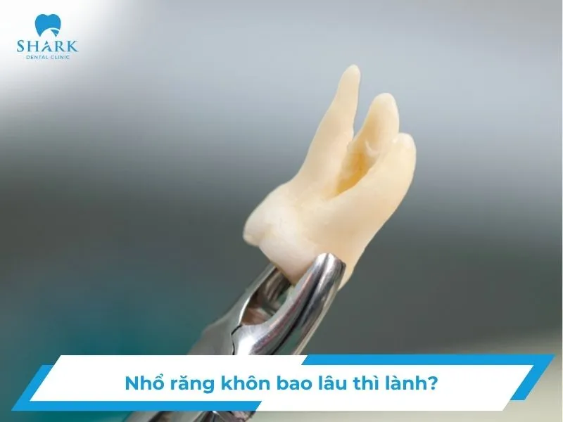 nho-rang-khon-bao-lau-thi-lanh_1_11zon