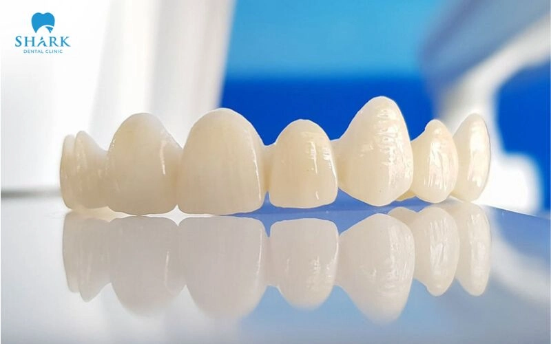 Bọc răng sứ cho răng hô nhẹ được không? Khi nào nên bọc? 9 Bọc răng sứ giúp cải thiện tình trạng răng hô nhẹ hiệu quả nhưng không phù hợp với trẻ dưới 18 tuổi khi xương hàm vẫn đang phát triển