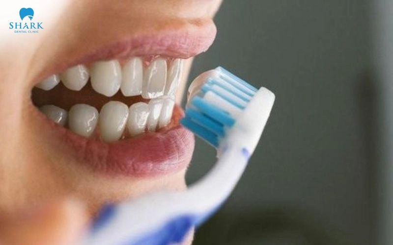 Bọc răng sứ có bị sâu không? Có gây nguy hiểm không? 11 Thường xuyên chải răng 2-3 lần/ngày bằng bàn chải lông mềm kết hợp chỉ nha khoa hoặc máy tăm nước để làm sạch kẽ răng
