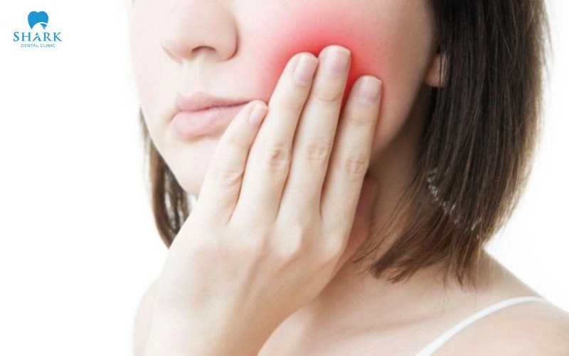 Cắm Implant bao lâu thì hết sưng? Nguyên nhân bị sưng dai dẳng 9 Cắm Implant bị sưng bao lâu? Thời gian sưng đau thường kéo dài trong khoảng 5-7 ngày sau cấy ghép