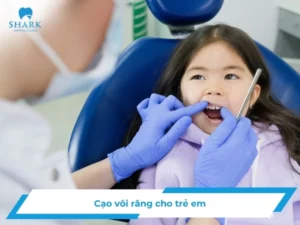 Cạo vôi răng trẻ em có nên thực hiện hay không?