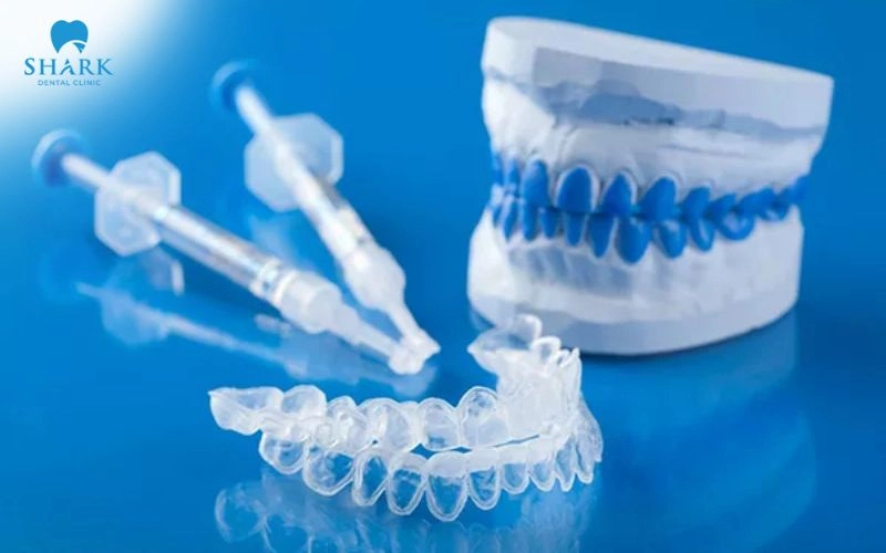 Máng ngậm tẩy trắng răng là gì? Hiệu quả nhanh không? 10 Máng tẩy trắng giúp cải thiện màu sắc của răng hiệu quả và an toàn tại nhà