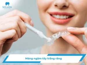 Máng ngậm tẩy trắng răng là gì? Hiệu quả nhanh không?