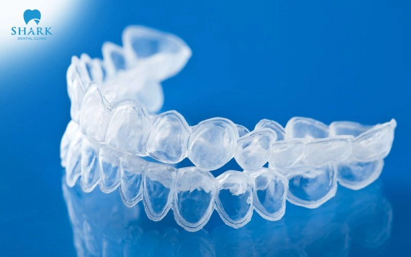 Máng ngậm tẩy trắng răng là gì? Hiệu quả nhanh không? 16 Chi phí thực hiện tẩy trắng răng bằng máng tại nhà hiện dao động trong khoảng từ 750.000 - 3.500.000 VNĐ/răng
