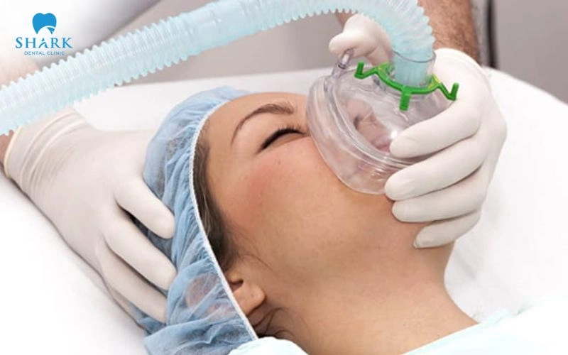 Nhổ răng khôn gây mê cần nhịn ăn trước khi thực hiện theo hướng dẫn của bác sĩ, thường ít nhất 6 giờ kể cả khi ăn sáng