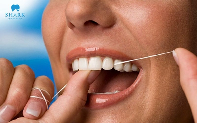 Nên sử dụng chỉ nha khoa hoặc tăm nước để loại bỏ thức ăn thừa và mảng bám còn sót trên răng