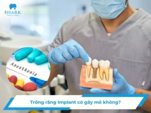 Trồng răng Implant có gây mê không? Khi nào cần an thần?