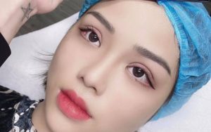 Mí mắt đẹp sắc nét sau khi nhấn mí ở MYLAN Beauty