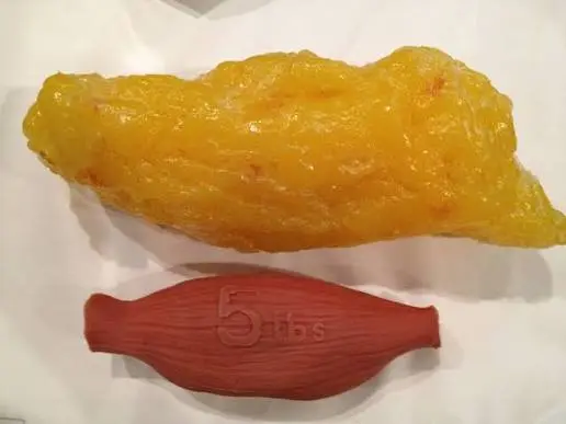 1kg mỡ cơ thể tương đương bao nhiêu calo?