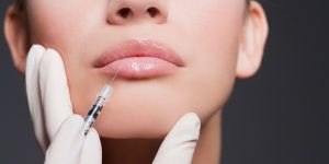 Lượng cc được tiêm quyết định chi phí tiêm filler môi