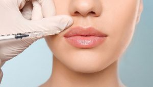 Bác sĩ tay nghề khéo léo sẽ giúp ca tiêm môi thành công