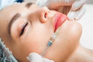 Khi chọn địa chỉ tiêm filler môi cần tìm hiểu về công nghệ được ứng dụng