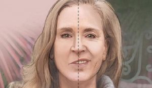 Mặt lệch ảnh hưởng nhiều đến thẩm mỹ