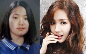 Park Min-young phẫu thuật gọt mặt giúp nhan sắc nâng tầm, sự nghiệp đi lên
