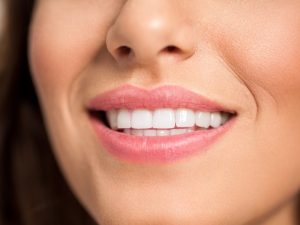 Giá tẩy trắng răng hết bao nhiêu tiền phụ thuộc vào đâu