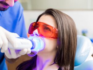 Đi nha khoa làm trắng răng sẽ đảm bảo được hiệu quả về mặt thẩm mỹ và tính an toàn