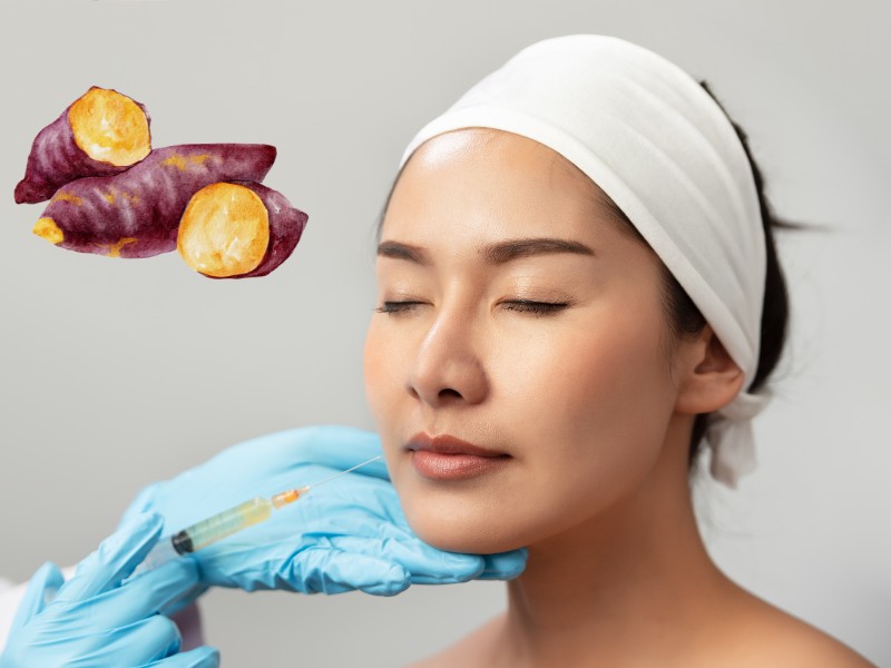  Tiêm filler mặt ăn khoai lang được không là thắc mắc của nhiều người