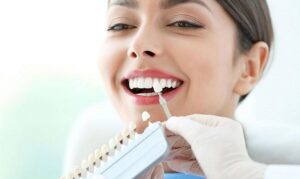 So sánh răng sứ Emax và Cercon cụ thể nhất