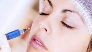 Tiêm dặm filler ít nhất 2-3 tuần sau khi tiêm lần đầu để hoàn thiện quá trình làm đẹp