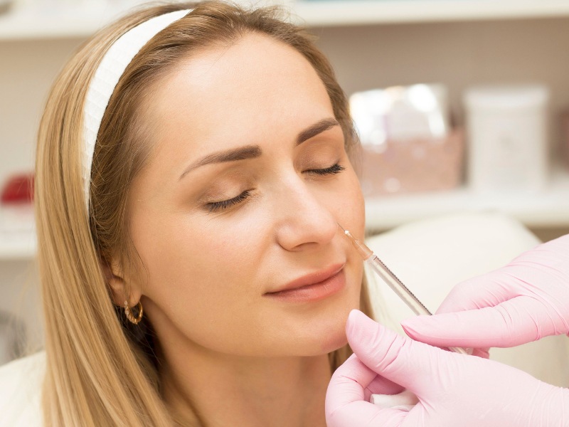 Tiêm filler mũi là một hình thức nâng mũi không phẫu thuật được nhiều người yêu thích, lựa chọnTiêm filler mũi là một hình thức nâng mũi không phẫu thuật được nhiều người yêu thích, lựa chọn